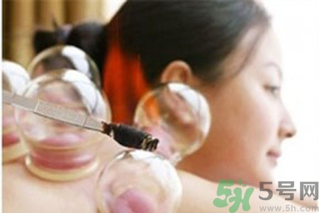 月經(jīng)可以拔火罐嗎？經(jīng)期可以拔火罐嗎？