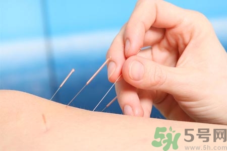 針灸一次要扎多長(zhǎng)時(shí)間？針灸可以幾天做一次？