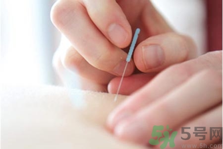 針灸一次要扎多長(zhǎng)時(shí)間？針灸可以幾天做一次？