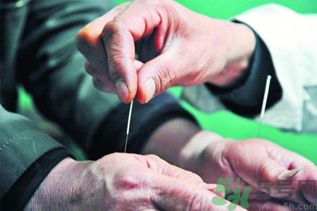 針灸一次要扎多長(zhǎng)時(shí)間？針灸可以幾天做一次？