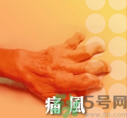 骨關(guān)節(jié)炎能治好嗎？骨關(guān)節(jié)炎平時注意事項