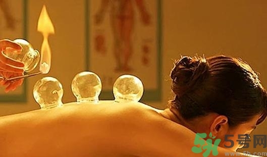 在家拔罐需要注意什么？在家拔罐幾天拔一次？