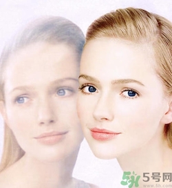 曬斑可以自己消退嗎？曬斑可以用激光去除嗎？