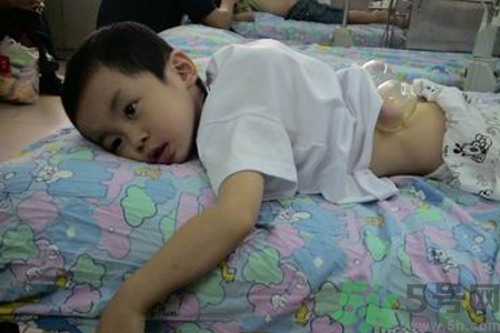 小孩可以拔罐嗎？寶寶能拔火罐嗎？