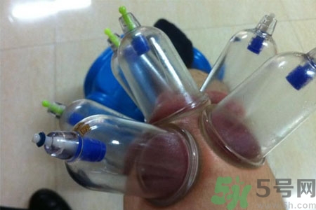 膝蓋能拔罐嗎？膝蓋疼可以拔罐嗎？