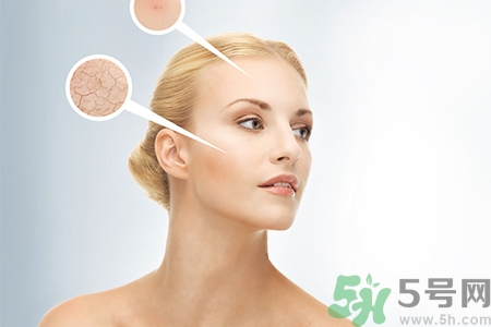 甘油會(huì)堵塞毛孔嗎？甘油堵塞毛孔怎么辦？