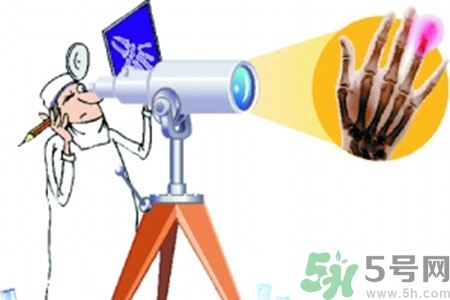什么年齡測(cè)骨齡最好？如何測(cè)骨齡？