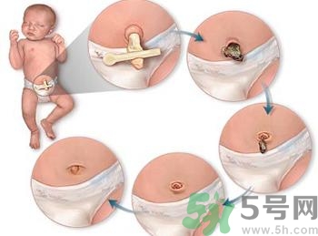 新生兒肚臍可以碰水嗎？新生兒肚臍沒(méi)脫落能洗澡嗎？