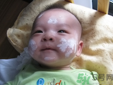 新生兒濕疹可以用爐甘石洗劑嗎？新生兒濕疹的護(hù)理措施