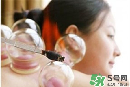拔罐放血對身體好嗎？拔罐放血有什么好處？