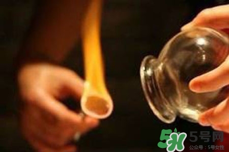 拔罐放血對身體好嗎？拔罐放血有什么好處？