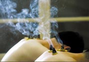 落枕能艾灸嗎？艾灸治療落枕有用嗎？