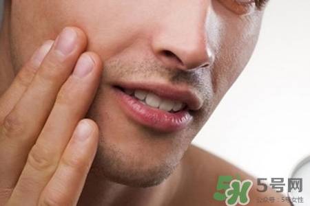 男人臉上酒刺怎么去掉？臉上長(zhǎng)酒刺是怎么回事？