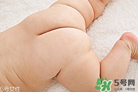 擴(kuò)肛疼嗎？擴(kuò)肛手術(shù)會很疼嗎？