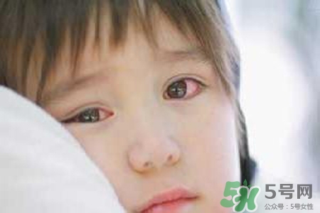 孩子為什么老眨眼睛？孩子總眨眼睛怎么回事？
