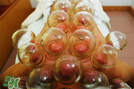 拔罐后皮膚發(fā)癢是怎么回事？拔罐后為什么皮膚會(huì)癢？