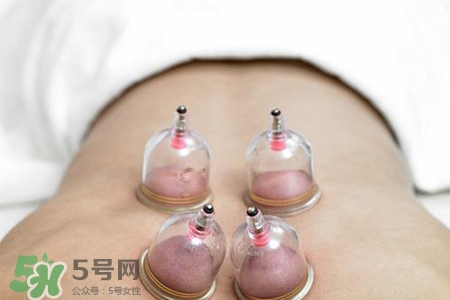 冬天拔罐后多久能洗澡？警惕冬季拔罐后不宜立即洗澡