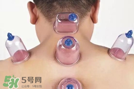 拔罐后可以喝酒嗎？拔罐后多久能喝酒？