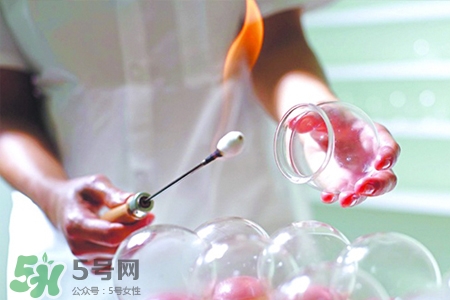 拔罐后可以泡澡嗎？拔罐后多久能泡澡？