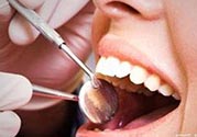 拔牙之后可以吃藥嗎？拔牙之后要不要吃藥？