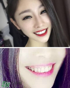 碧緹福冷光牙齒美白儀怎么用？碧緹福冷光牙齒美白儀使用方法