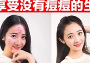 伊詩蘭頓祛痘怎么樣？伊詩蘭頓祛痘膏有用嗎？