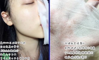 稚優(yōu)泉面膜怎么用？稚優(yōu)泉面膜要洗嗎？