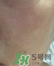 skin1004是什么牌子？skin1004屬于什么檔次