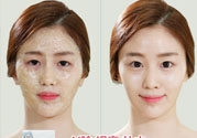 skin1004是什么牌子？skin1004屬于什么檔次