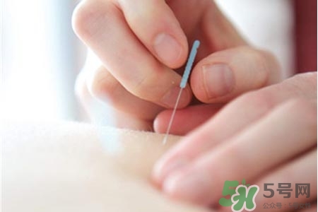 腰間盤突出可以針灸嗎？針灸能治腰間盤突出嗎？
