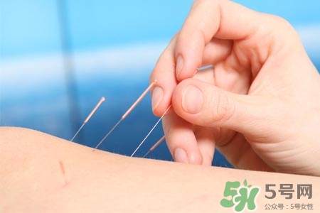 腰間盤突出可以針灸嗎？針灸能治腰間盤突出嗎？