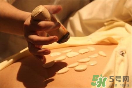 口臭可以艾灸嗎？口臭艾灸哪里？