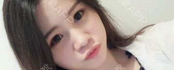 定點(diǎn)雙眼皮能保持多久？定點(diǎn)雙眼皮是永久的嗎？