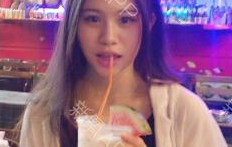 定點(diǎn)雙眼皮能保持多久？定點(diǎn)雙眼皮是永久的嗎？