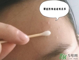 星期四農(nóng)莊茶樹精油怎么用？星期四農(nóng)莊茶樹精油使用方法