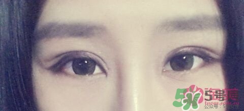 切開雙眼皮多久消腫？切開雙眼皮多久恢復(fù)？