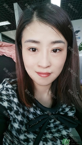 埋線雙眼皮能保持多久？埋線雙眼皮是永久嗎