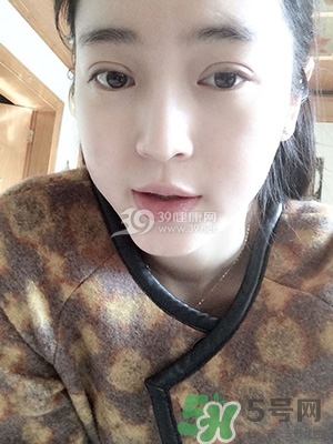 什么是定點雙眼皮？定點雙眼皮多少錢？