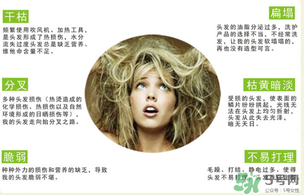N7發(fā)膜多少錢一盒？N7發(fā)膜價(jià)格