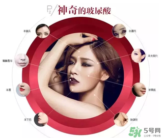 喬雅登是哪個國家的？喬雅登玻尿酸哪個國家？