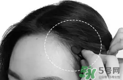 發(fā)際線高適合什么發(fā)型？發(fā)際線高怎么辦