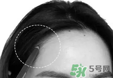 發(fā)際線高適合什么發(fā)型？發(fā)際線高怎么辦
