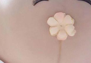 妊娠線每個孕婦都有嗎？妊娠線出現(xiàn)的時間