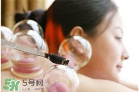 冬天可以拔罐放血嗎？冬天拔罐放血好嗎？