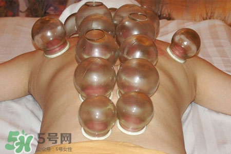 冬天可以拔罐放血嗎？冬天拔罐放血好嗎？
