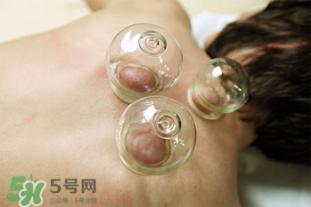 拔罐放血會(huì)得傳染病么？拔罐放血會(huì)傳染疾病嗎？
