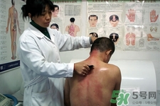 刮痧可以去濕氣嗎？體內(nèi)濕氣重刮痧有用嗎？