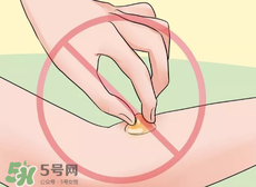 水泡怎么處理？水泡要不要刺破？