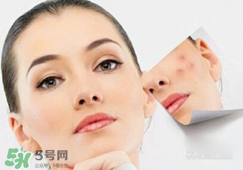 封閉性粉刺會(huì)自己消失嗎？封閉性粉刺好了會(huì)留疤嗎？