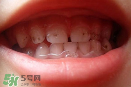 刷牙后吃東西發(fā)苦正常嗎？為什么刷牙后吃東西發(fā)苦？